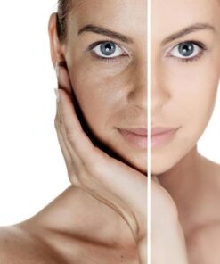 PIGMENTACIÓN - ILUMINACIÓN